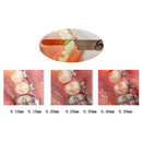 Dental Orthodontic Interproximal Enamel Reduction IPR Gauge Ruler