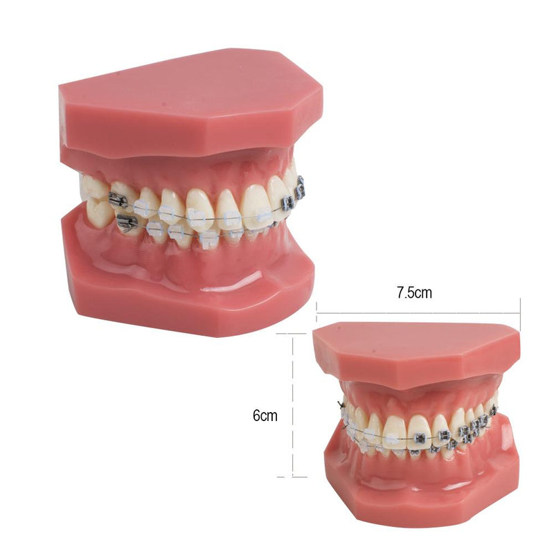 Dental Teeth Study Orthodontic Red Model with Metal and Ceramic Brackets