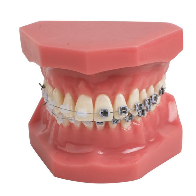 Dental Teeth Study Orthodontic Red Model with Metal and Ceramic Brackets