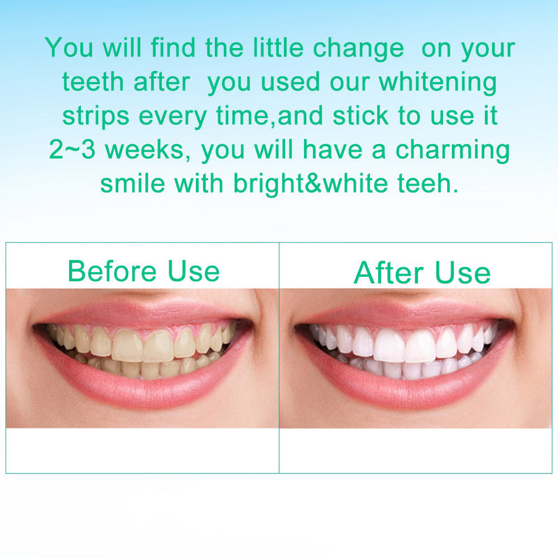 Teeth Whitening Strips Bamboo Charcoal Teeth Whitening Kit