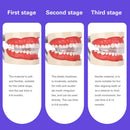 Dental Orthodontic Braces Appliances Kids Teeth Trainer Retainer Mouth Gard Tooth Tray Blue Purple Soft Hard