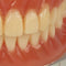 Standard Study Teach Teeth Model