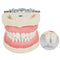 Soft Gum Teach Standard Teeth Model