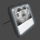 New Light Box Illumination Viewer Panel X-Ray