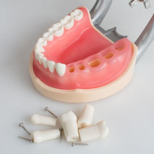 Dentist 200H Type Universal Teeth Model