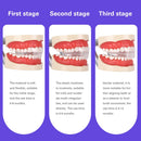 Soft and Hard Tooth Orthodontic Appliance Aligners Trays Teeth Straightener